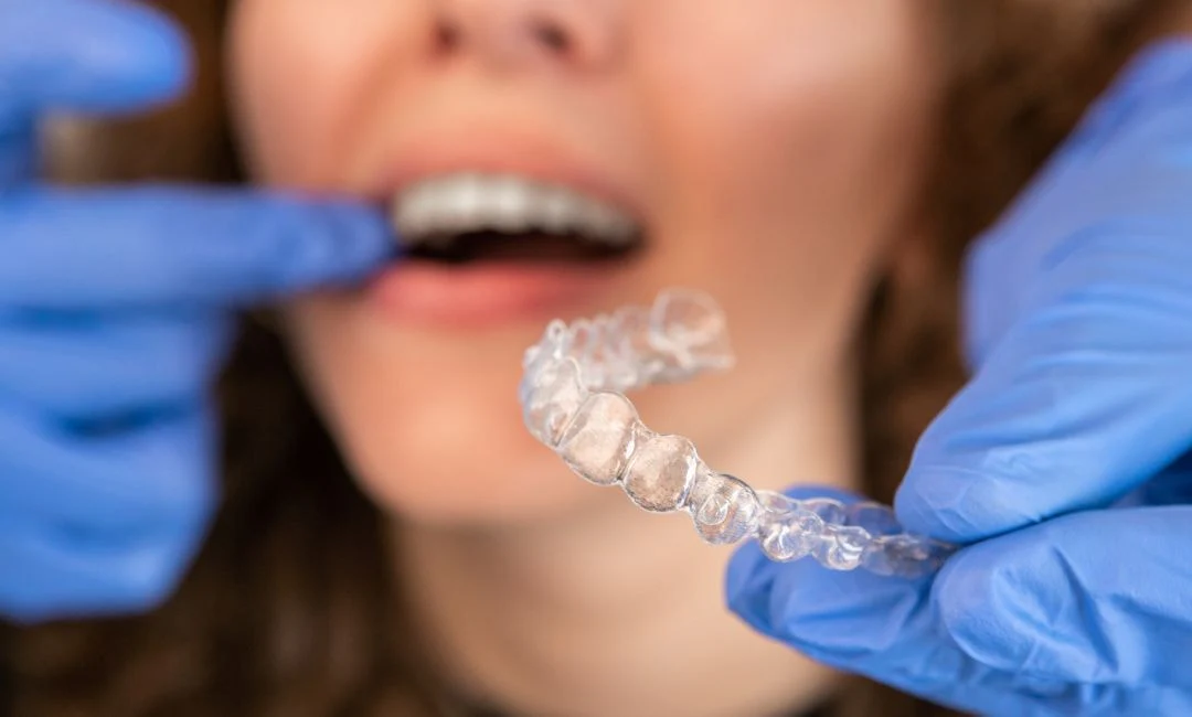 Prescribe Clear Aligners