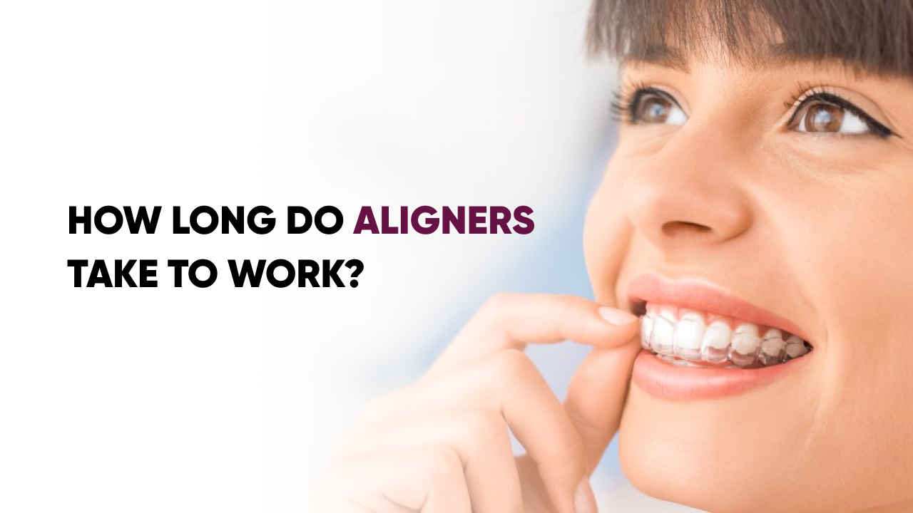 Aligners Take to Work