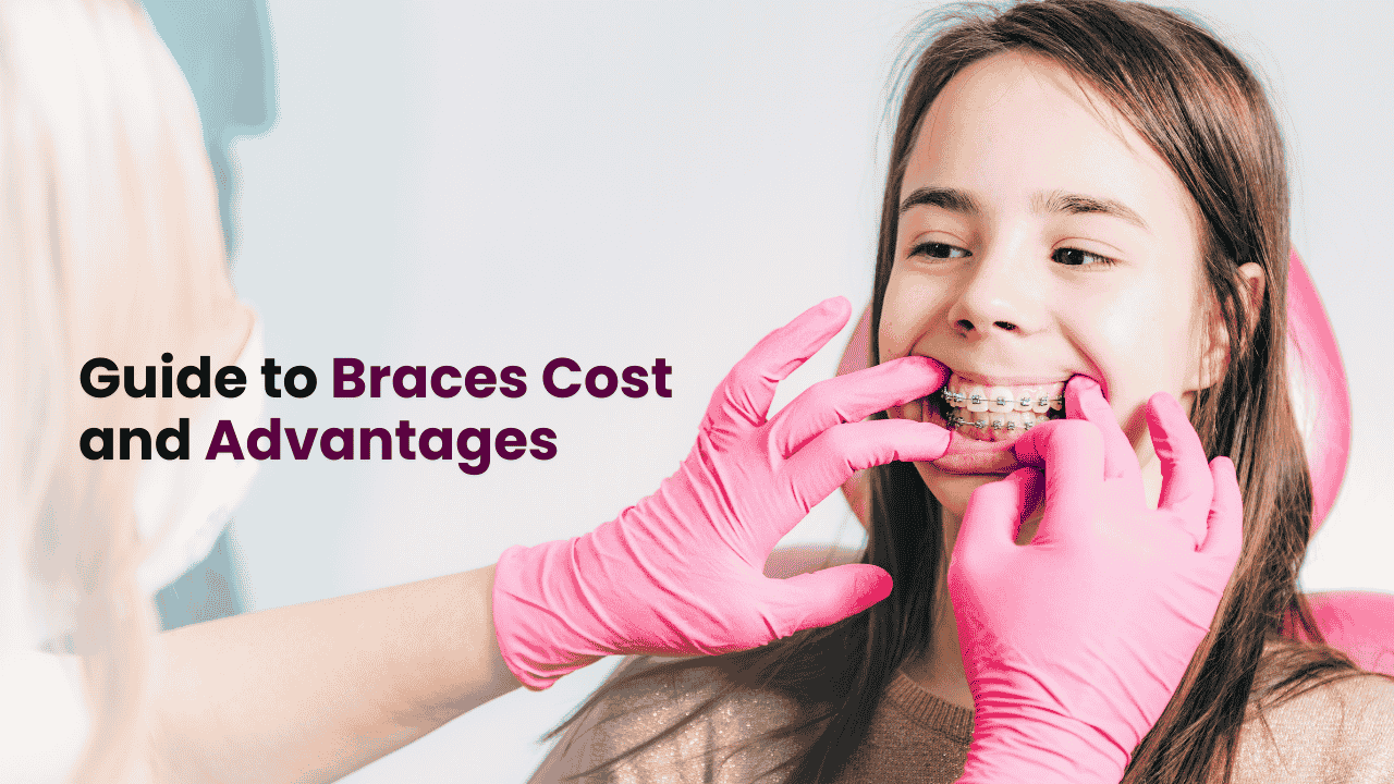 Braces in Los Angeles