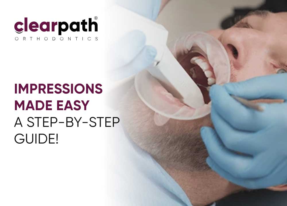 Dental Impressions Process