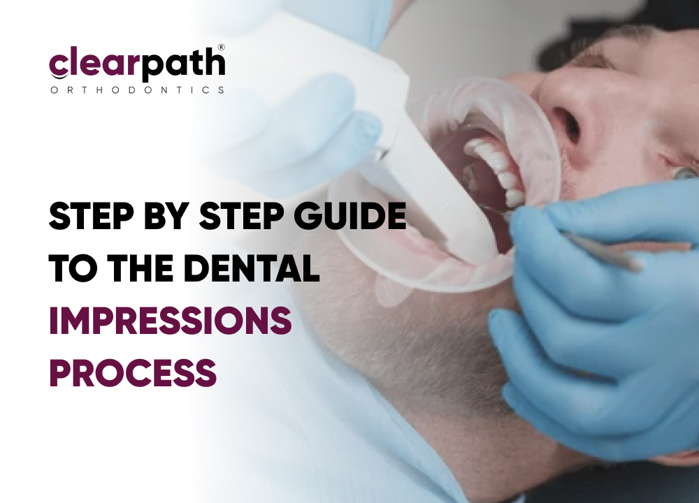 Dental Impressions