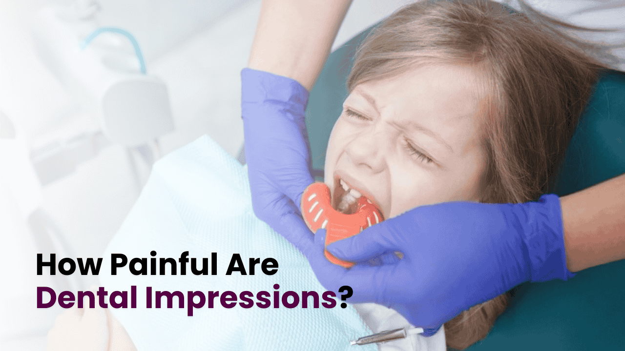 Dental Impressions