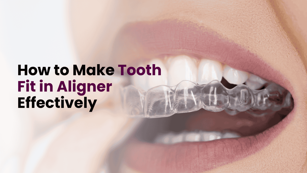 Tooth Fit in Aligner