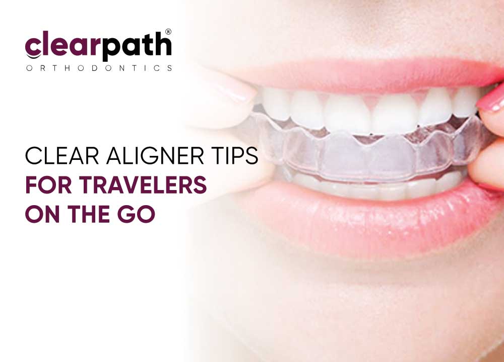 Clear Aligner Travel Hacks