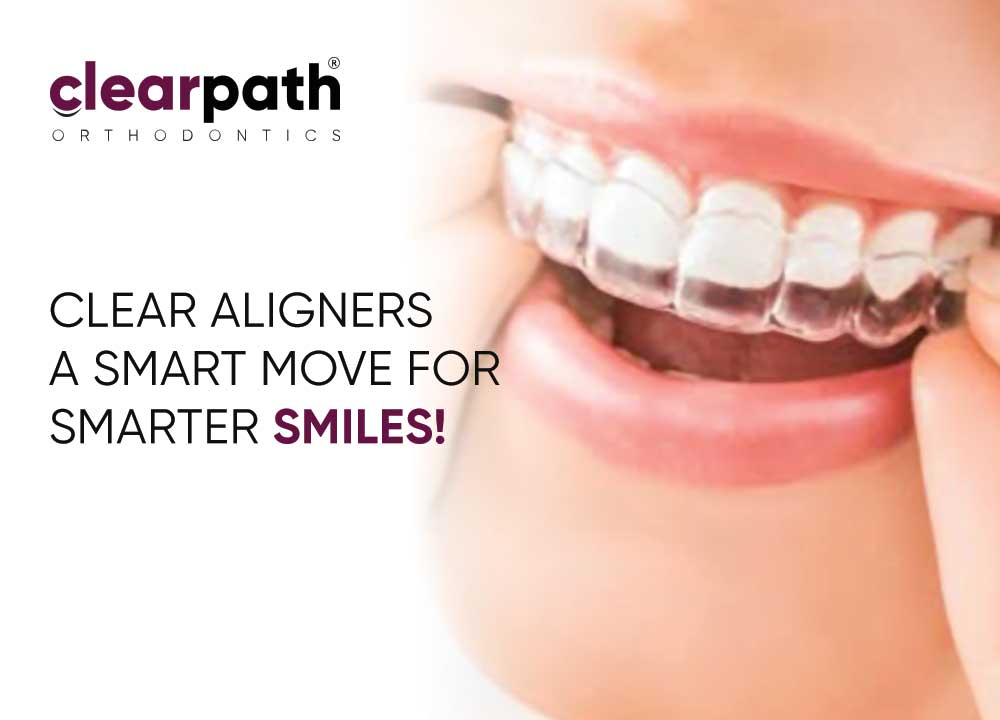 Prescribe Clear Aligners